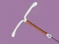 Stérilet en cuivre, une option contraceptive qui n'affecte généralement pas le libido.