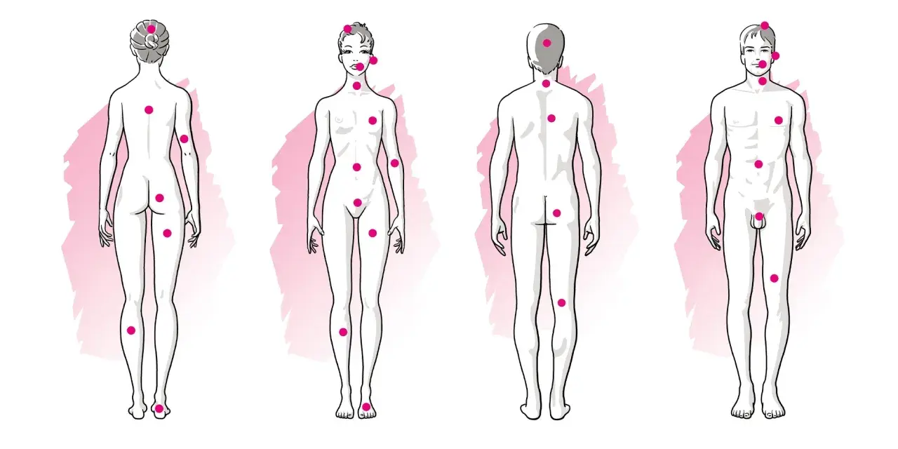 Schémas corporels féminins et masculins avec des points roses indiquant des zones érogènes, suggérant une forte libido.