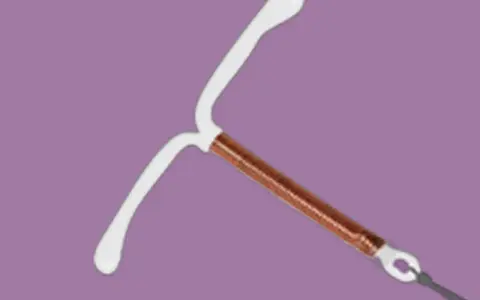 Stérilet en cuivre, une option contraceptive qui n'affecte généralement pas le libido.
