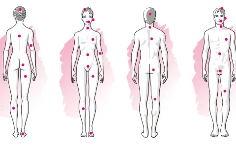 Schémas corporels féminins et masculins avec des points roses indiquant des zones érogènes, suggérant une forte libido.
