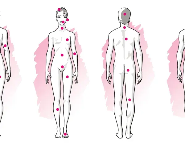 Schémas corporels féminins et masculins avec des points roses indiquant des zones érogènes, suggérant une forte libido.